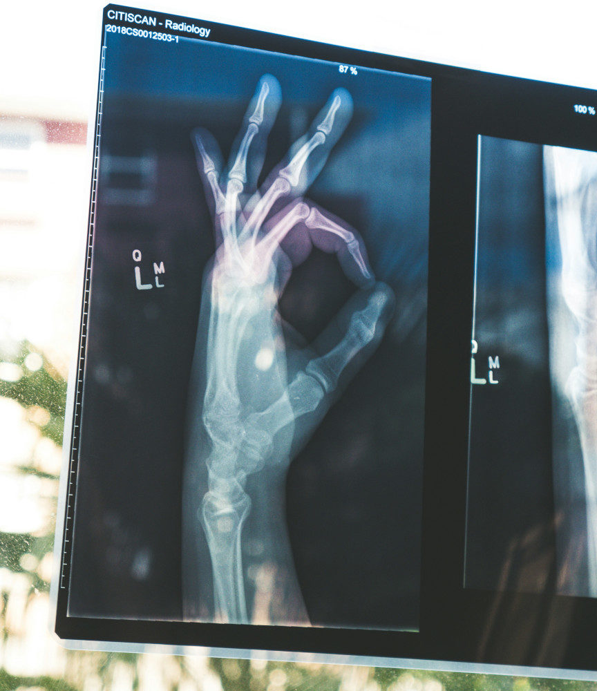 Soutenir la réparation osseuse suite à une fracture avec la gemmothérapie